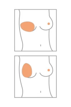 Amoena Teilprothese Balance Essential Thin Oval -Mode Dessous Geschäft Amoena Brustprothesen Form Oval min 1280x1280 1