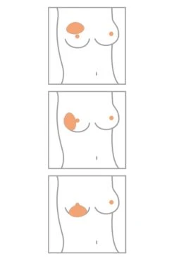 Amoena Teilprothese Balance Natura Special Varia 7 Amoena Teilprothese Balance Natura Special Varia -Mode Dessous Geschäft Amoena Brustprothesen Form Varia min 1280x1280